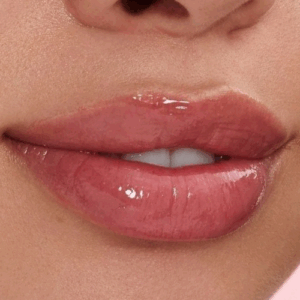 Hidralips – cosmetología
